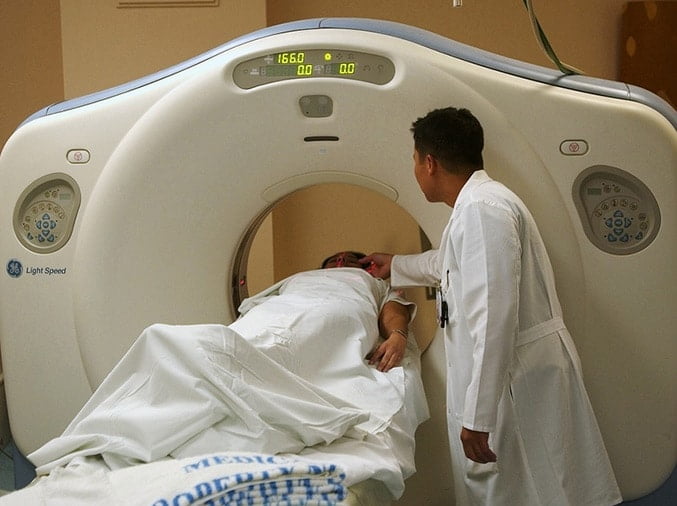 five things you need to know about brain injury-cases