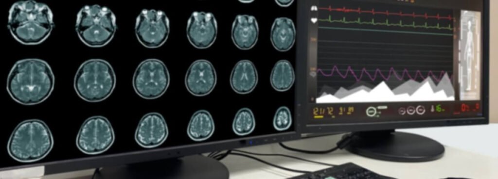 brain mri results on monitor